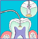 graphic illustration of standard probing