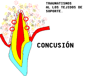 trauma1gif.gif (11653 bytes)